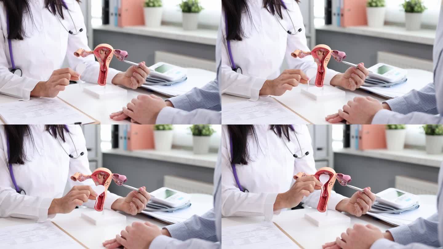 妇科医生在子宫模型上展示患者受精过程
