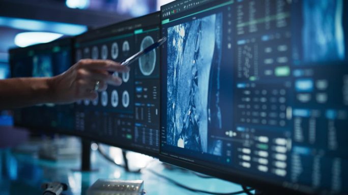 现代医学研究中心:匿名医生指着台式电脑显示器，用CT扫描人类脊髓。专家寻找肿瘤或损伤，寻找治疗方法。