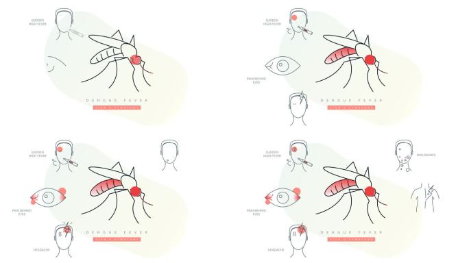 登革热(DENV) -主要症状-库存动画插图