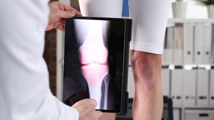 医生用数码平板4k电影做膝关节电脑检查