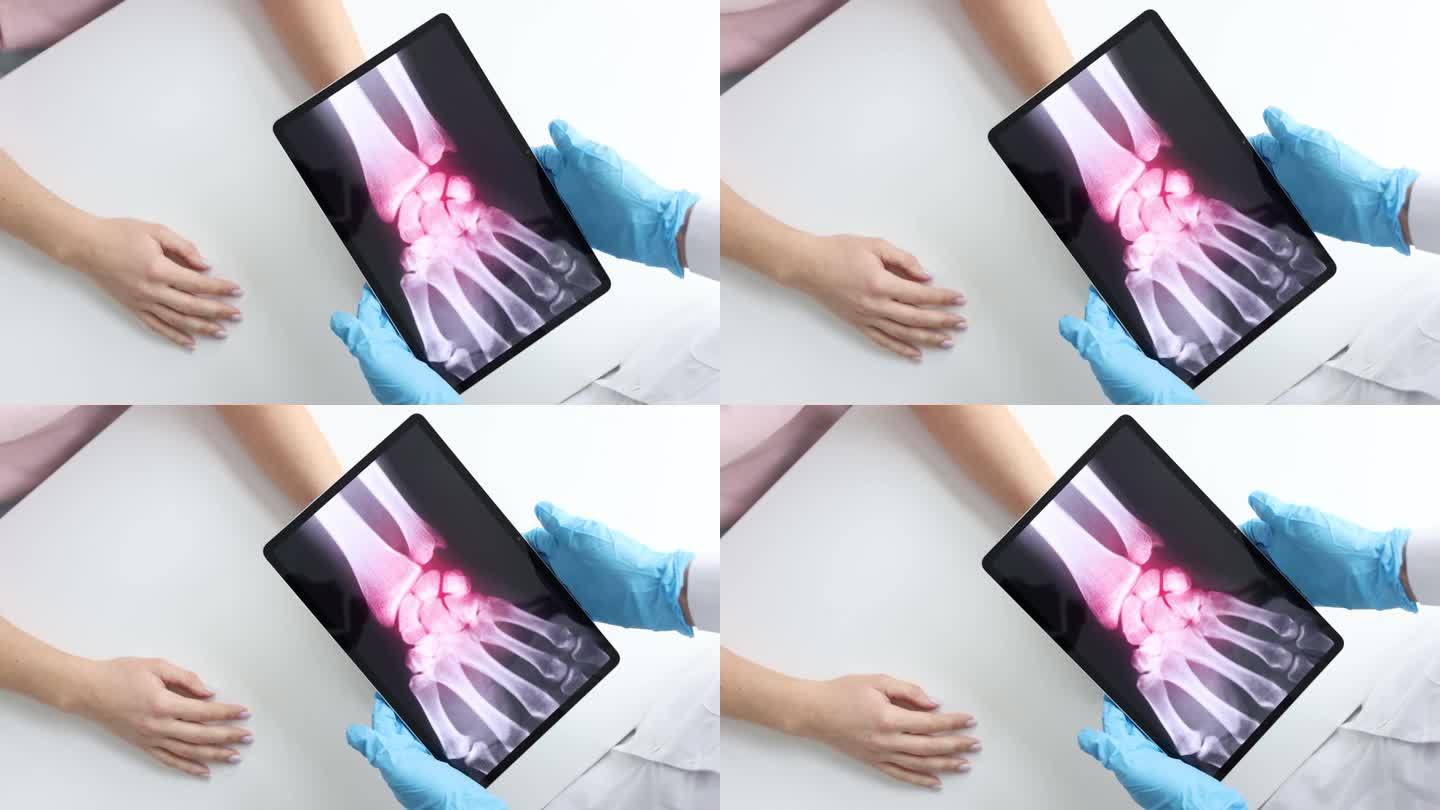 医生拿着病人手x光片的平板，慢动作4k电影