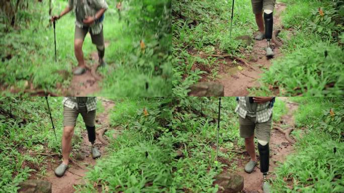 亚洲残障男子戴上假腿，在森林中拄着登山杖走在小路上，进行锻炼和自然探索;男性自然探险家进行徒步旅行和