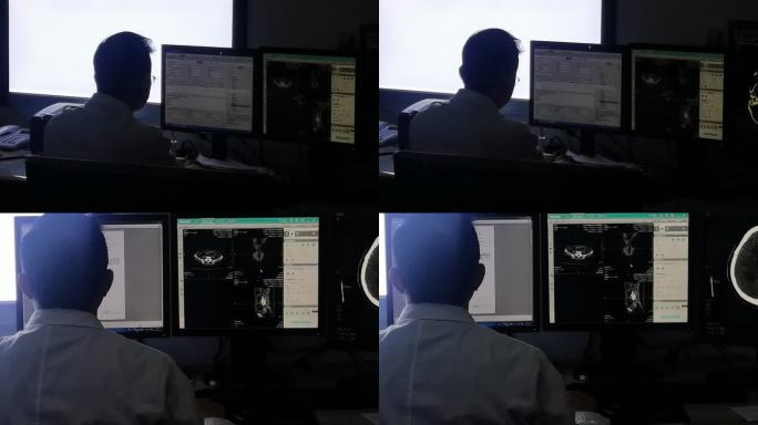x光放射科医生在电脑前看片子问诊