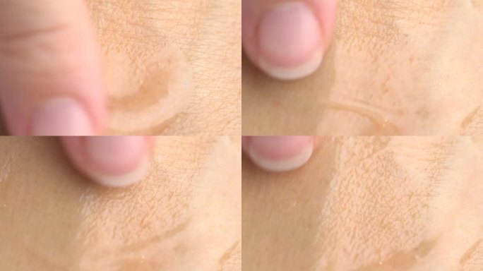 女性在干燥皮肤上涂抹透明精华凝胶的特写镜头。非常干燥的皮肤。含透明质酸的精华油，女性用手涂抹，护肤化