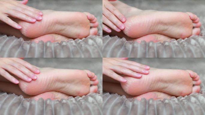 脚后跟皮肤干燥保湿方法问题预防