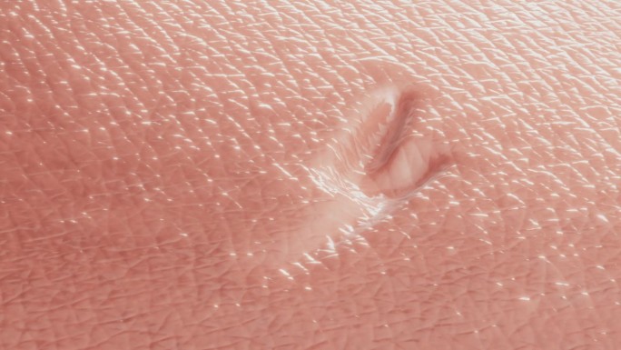 激光皮肤治疗。去除疤痕及皮肤表面修复。三维渲染