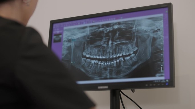 牙医医生在电脑屏幕上检查下巴的全景x光片。医生展示了病人口腔的3D模型，核磁共振扫描。现代牙科诊所的