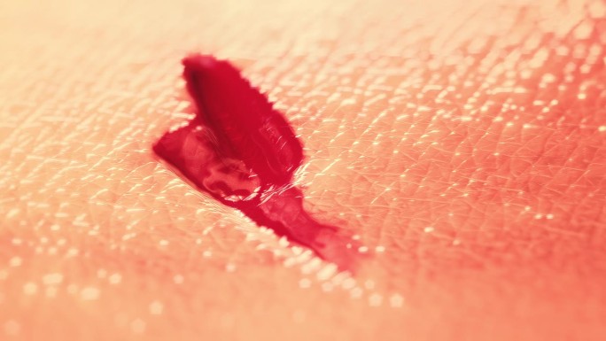 皮肤疤痕再生。3D渲染-伤口与血液愈合并完全消失，只留下一个健康的皮肤纹理。