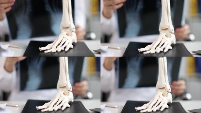 医生手术台上腿部的解剖模型