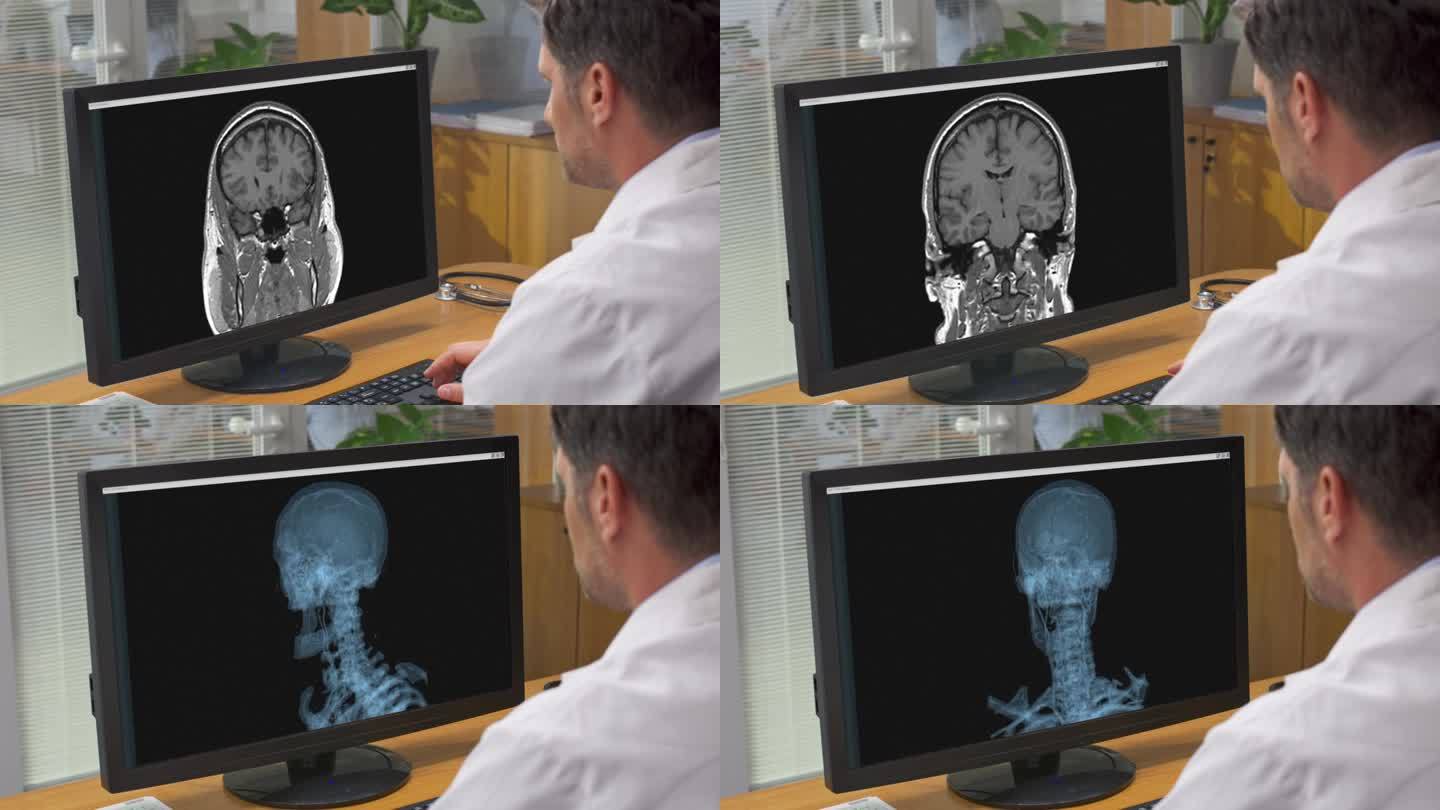 男医生正在办公室的电脑上看扫描结果
