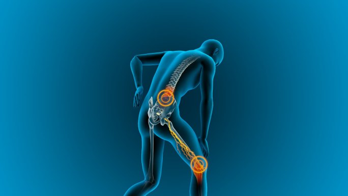 腰椎膝盖疼痛