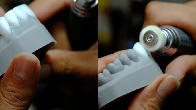 牙科技师用熟练的手指塑造新牙。