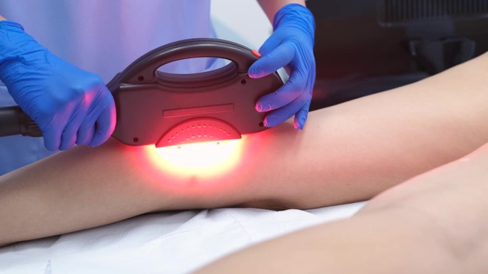 整形外科医生在女人的腿上使用激光设备