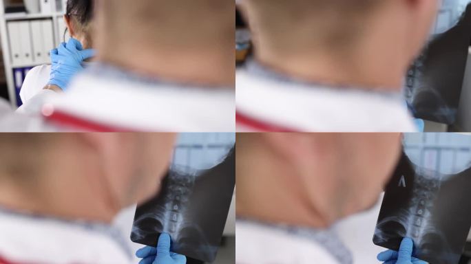 医生手里拿着颈椎的x光片，用慢动作4k电影诊断病人的颈部