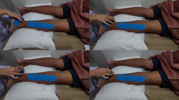 物理治疗师使用运动机能胶带贴在患者腿上，用于物理治疗和康复后的肌肉支撑和恢复。