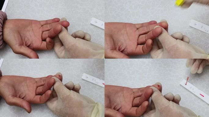 防艾滋病抽血测试手指采血收集化验采集血液