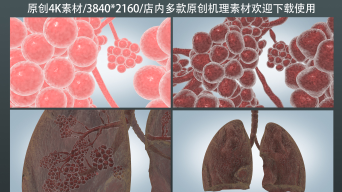 肺部感染病变机理