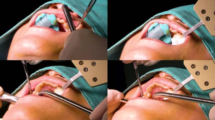 牙科手术
