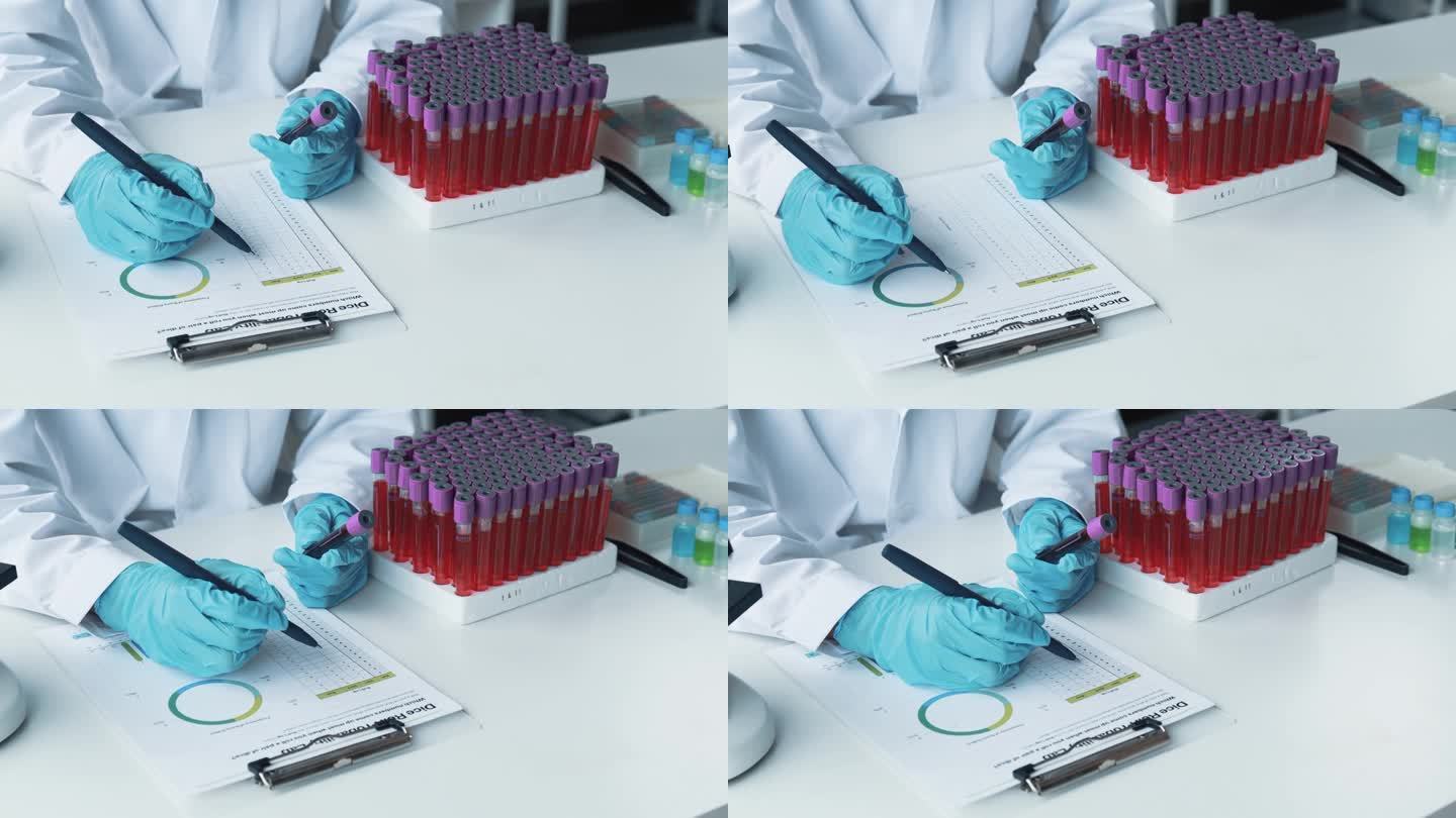 实验室助理，医学科学家，化学研究员拿着一根玻璃管穿过血液样本，做化学实验，检查病人的血液样本。医学和