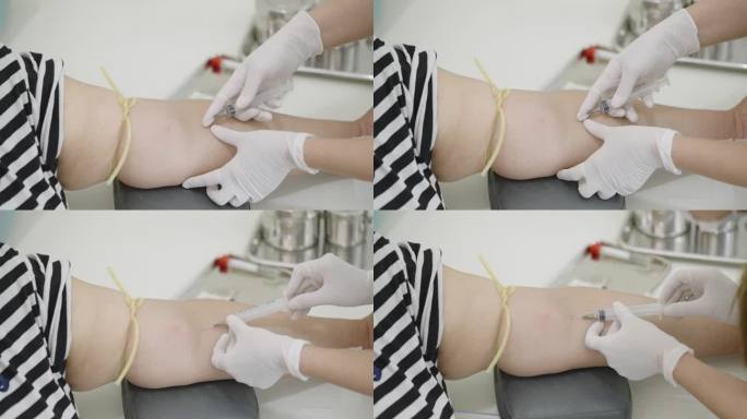 护士的手将针插入血管，并在注射器侧面画出