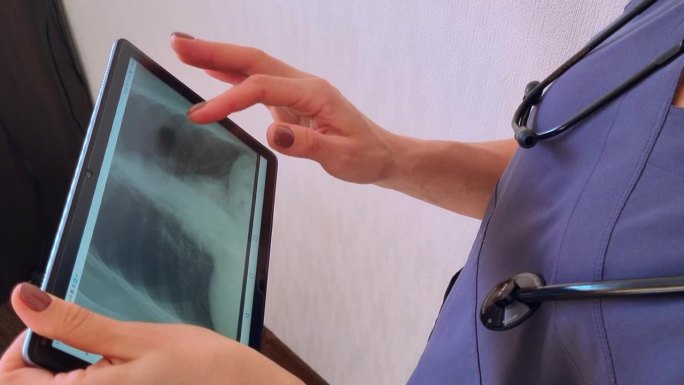 慢镜头，女医生穿着制服，对着白墙研究药片上肺部的x光图像。