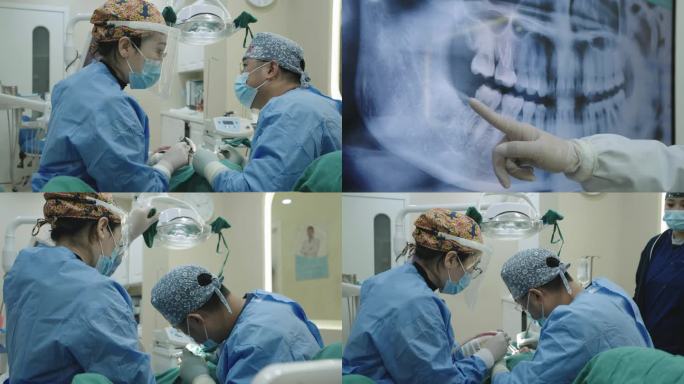 牙齿手术 手术牙齿x光