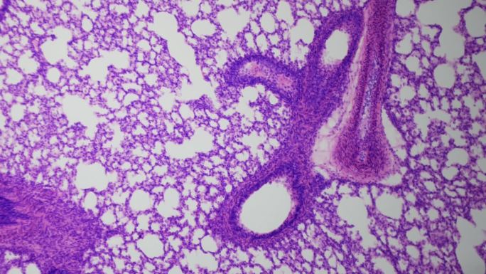 显微镜下人体肺的最薄切片。明场光学显微镜。放大100倍。肺的内部结构肺泡、支气管、血管等。