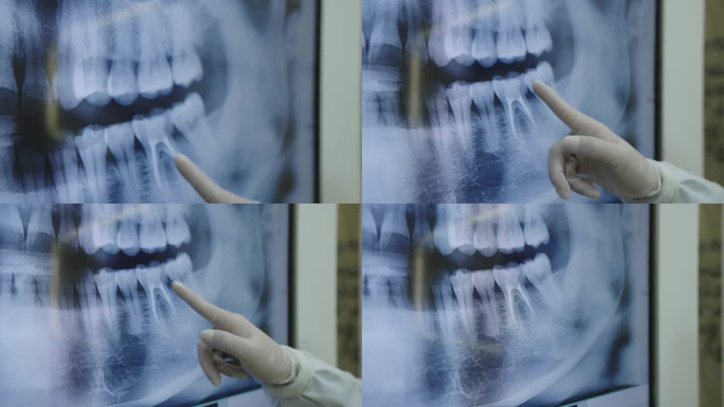 手术牙齿x光