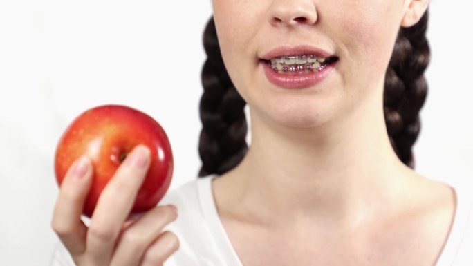 戴牙套的年轻白人妇女不能吃苹果的特写。白色背景。正畸治疗中禁忌食物的概念