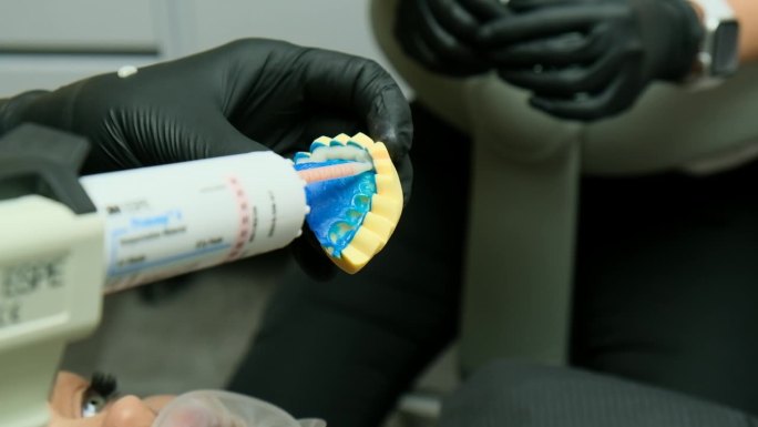 牙医将黏合剂涂在义齿模具上。特写镜头