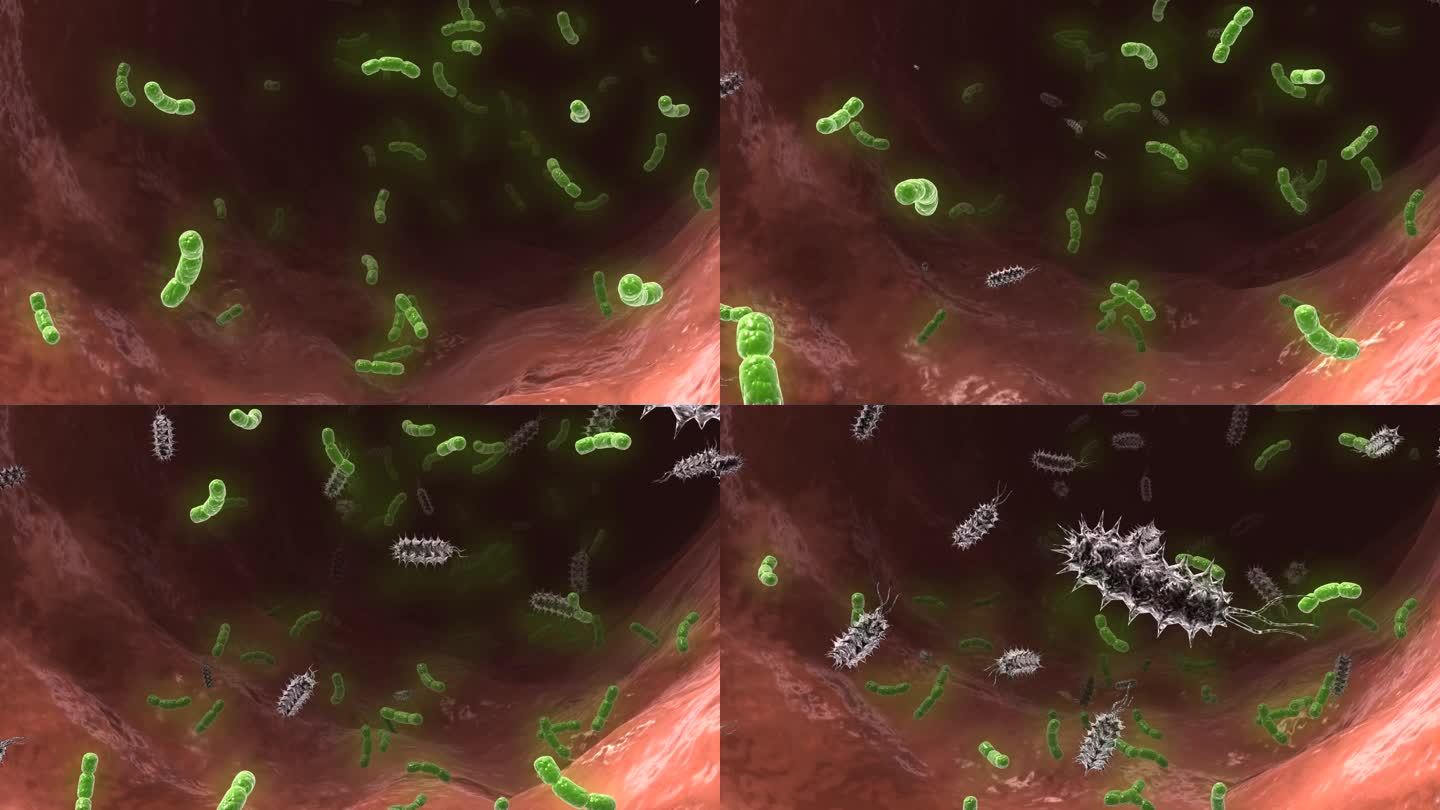 肠道内有害细菌滋生幽门螺旋杆菌益生菌减少