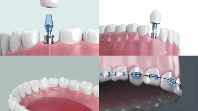 牙医牙齿动画