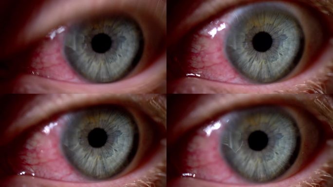 眼炎引起的充血性眼睛