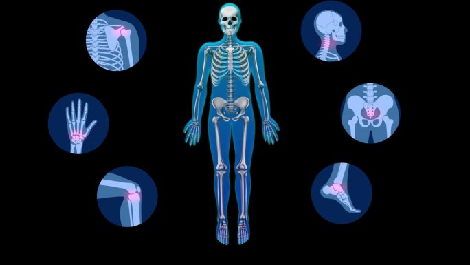 人体关节炎症及治疗动画。手，脚，脖子和背部发炎的骨头区域与治疗概念。关节炎和药物治疗