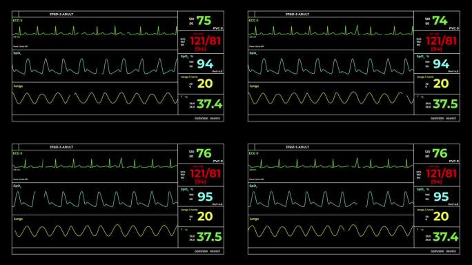 生命体征监测屏幕科技医治医疗