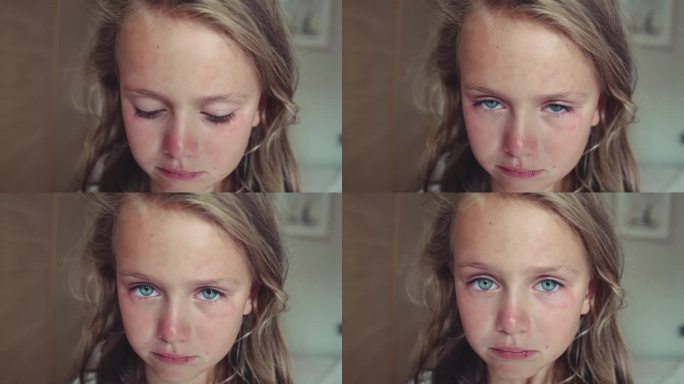 特写肖像悲伤难过的学步女孩睁开蓝色的大眼睛眼泪悲伤沮丧的问题，坏消息，损失压力暴力家庭受害者身体虐待