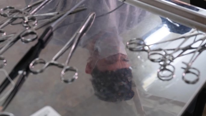 手术时外科医生在医疗器械桌面镜面上的反射。