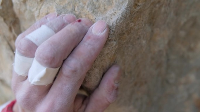 攀登新的高度:手缠绷带的登山者的坚韧之旅