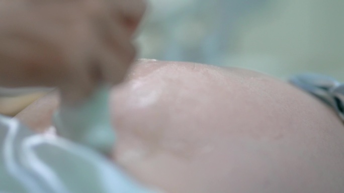 4K孕妇产检妇科四维彩超医生超声波检查