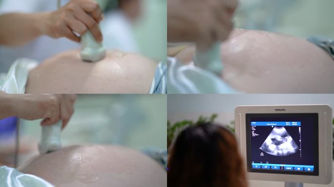 4K孕妇产检妇科四维彩超医生超声波检查