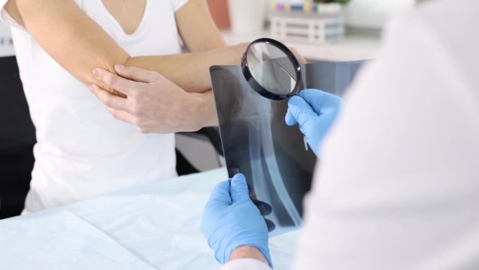 伤科医生拿着肘关节x光片和放大镜，对着生病的女病人看4k电影