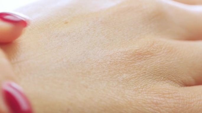 在女性手部干燥的皮肤上涂抹保湿乳液和面霜