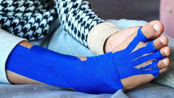 弹性治疗蓝带应用于儿童腿部。肌内效贴敷治疗损伤