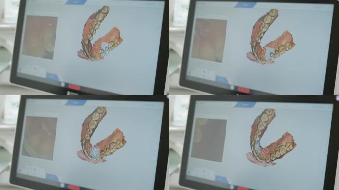 医生在诊所里扫描病人的牙齿。牙医手里拿着一个手动3D扫描仪，用来扫描下巴和嘴巴。牙齿健康。在医疗监视