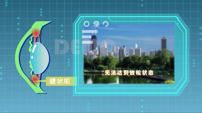 近视原理二维动画