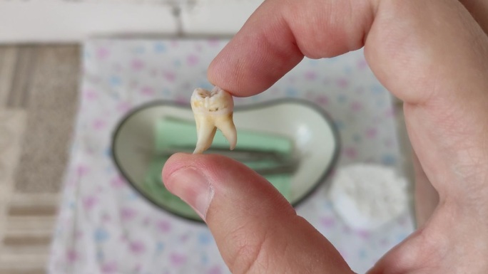 牙医手中拔出来的牙齿。