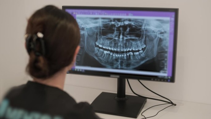 牙医医生在电脑屏幕上检查下巴的全景x光片。医生展示了病人口腔的3D模型，核磁共振扫描。现代牙科诊所的