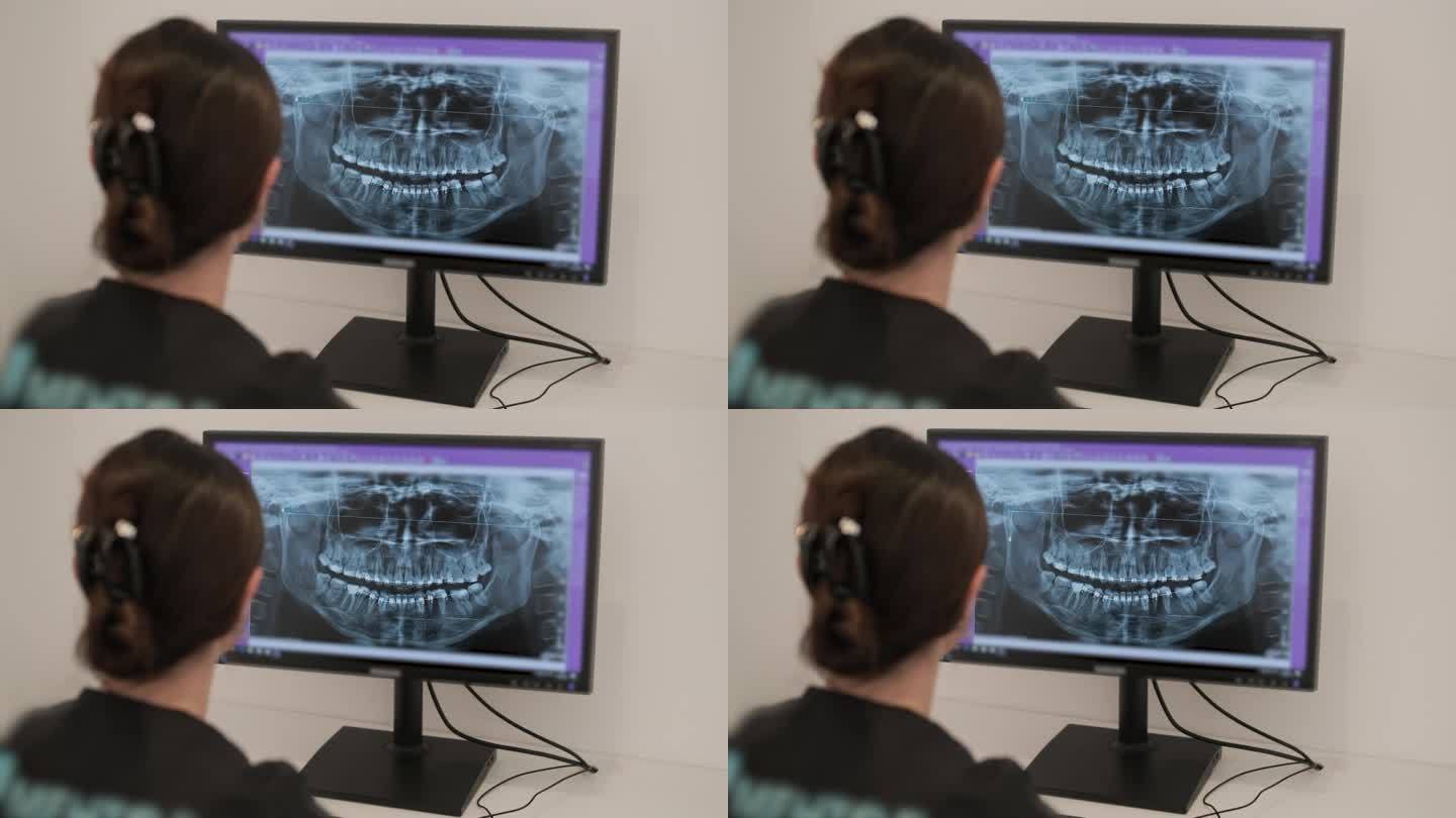 牙医医生在电脑屏幕上检查下巴的全景x光片。医生展示了病人口腔的3D模型，核磁共振扫描。现代牙科诊所的