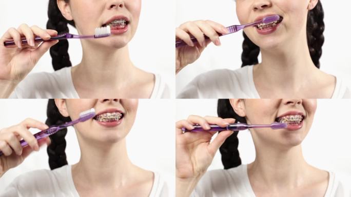 戴绑带牙套的年轻白人妇女用手动牙刷刷牙的特写。正畸治疗和牙齿护理的概念
