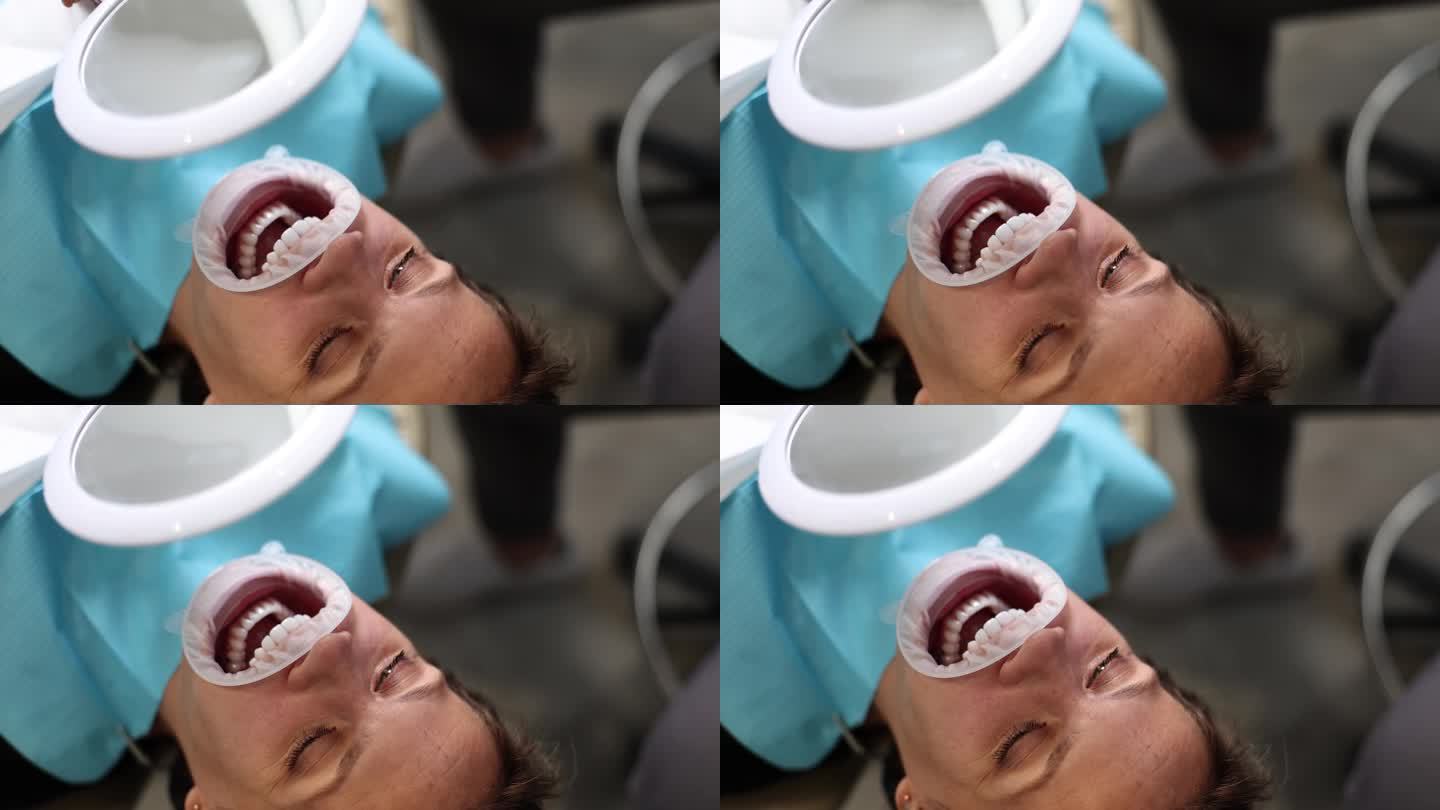 妇女在诊所检查牙贴面